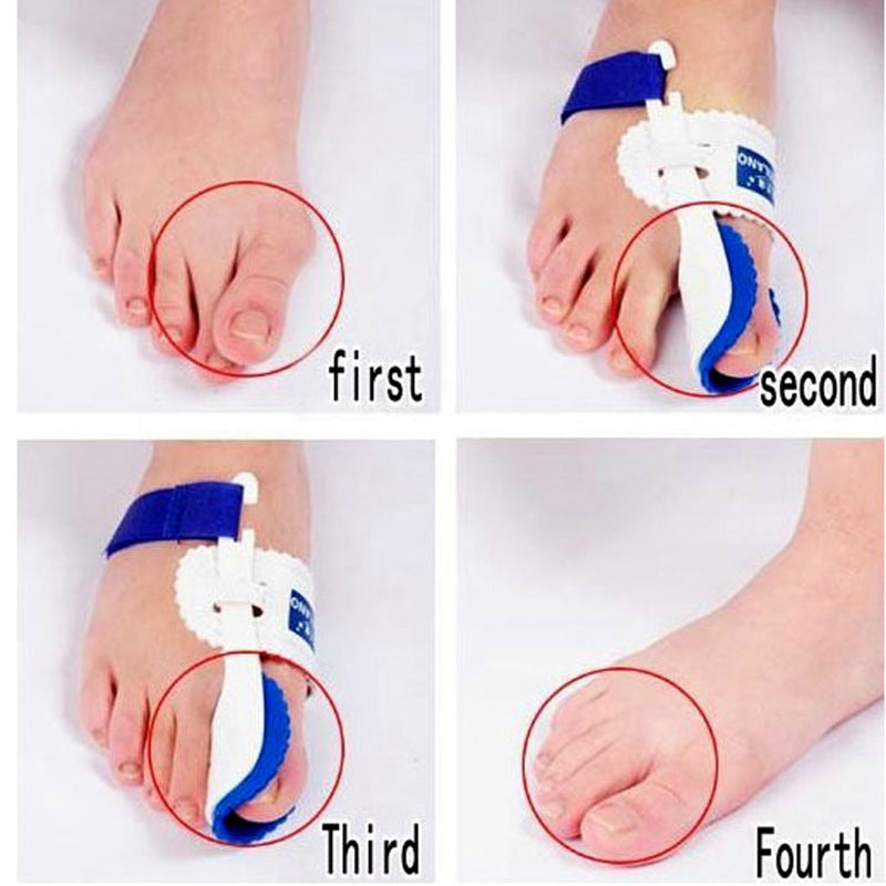 Bunion Device Hallux Valgus Orthopedic Braces